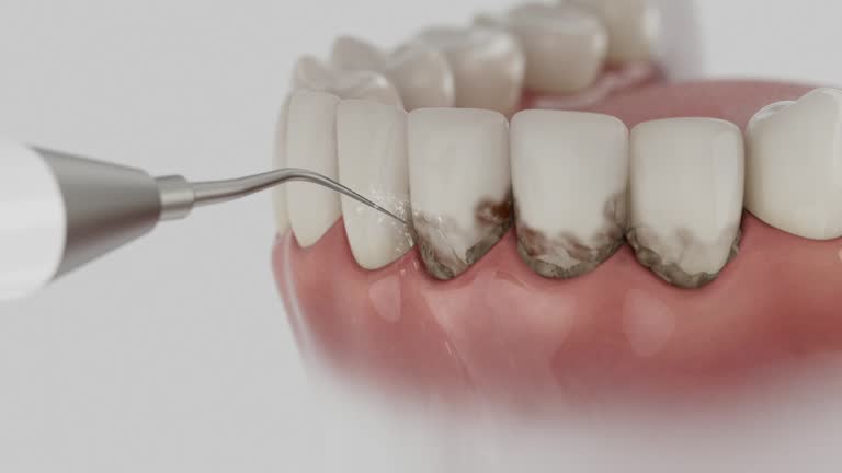 Trusted Invisalign Clear Aligners service in Camden, TN - Dentist Open Now